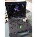 DW-C60 DAWEI Portable Laptop 4D Color Doppler Ultrasound System Machine Factory Price with CE ISO Approval